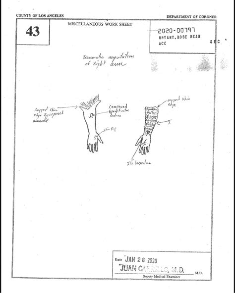 gigi and kobe autopsy report|Kobe Crash Autopsy Reports : r/CrimeScene